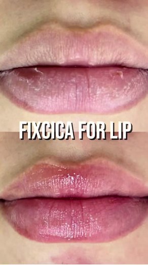 A lip recovery patch that works even when lip balm isn’t enough my nose was all raw from a cold 😭 It reminded me of the patch I used back then — Fixcica :) ✔️ Dimethicone → soft, strong moisture coating ✔️ Tocopherol → supports recovery of chapped lips ✔️ Vitamins → adds vitality antioxidant care It’s perfect as a lip primer before lipstick or as an overnight lip mask. A truly all-in-one item. (Highly recommended before bed) You can comment or DM just “Fixcica,” and I’ll send you the purchase l