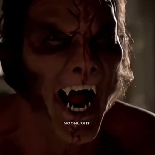 What's The Prob.....😱😱😱😱 #teenwolf #stilesstilinski #scottmccall #viral