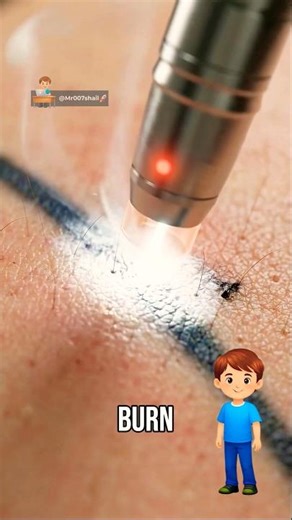 How Laser Actually Removes Tattoos!⚡️🤔 | Facts | Shorts | 3D Animation |