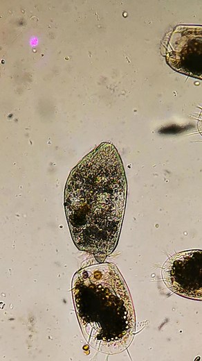 Euplotes sp. in binary splitting and Stentor. | Guido Guidotti