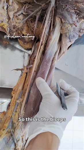 Anterior compartment of arm | Dissection