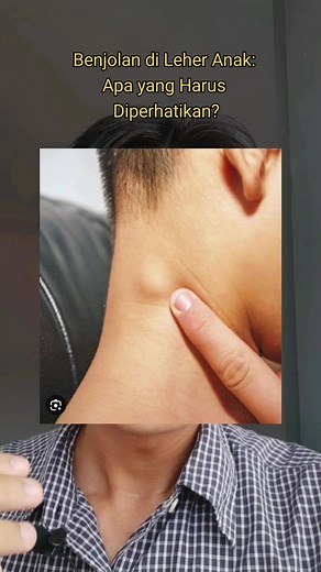 Benjolan di Leher Anak: Apa yang harus diperhatikan?? #edukasikesehatan #infokesehatan #infokesehatananak #dokterspesialosanak #dokterspesialistht #doktertht #benjolanleher #lymfadenopati #limfoma #leukemia #edukasianak #doktertiktok #dokterkeluarga #doktergantengwahyu #dokterthtwahyutn #doctorcha