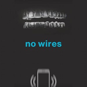 When it comes to teeth straightening, it’s time to go wireless! Discover the advanced, comfortable and less painful way to get the smile you want for your teen! David White et al., "Discomfort associated with Invisalign and traditional brackets: A randomized, prospective trial”. Study sponsored by Align Technology, Inc. Invisalign treatment is a series of clear plastic removable orthodontic aligners that gently move patients’ teeth. An orthodontist or Invisalign trained dentist will be able to a