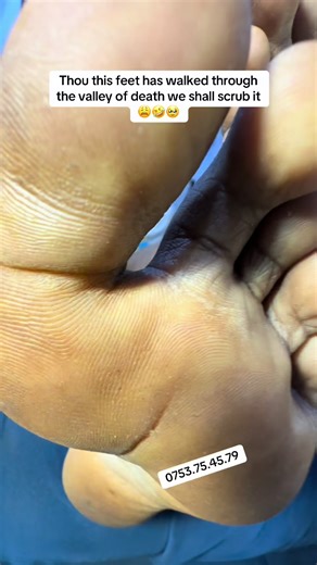 Revitalize Your Feet: The Ultimate Scrub Treatment