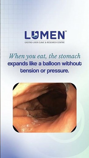 Bloating After Eating? Causes & Simple Explanation | Gut Health