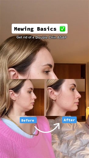 Mewing Tongue Posture: Say Goodbye to Double Chin with These Tips