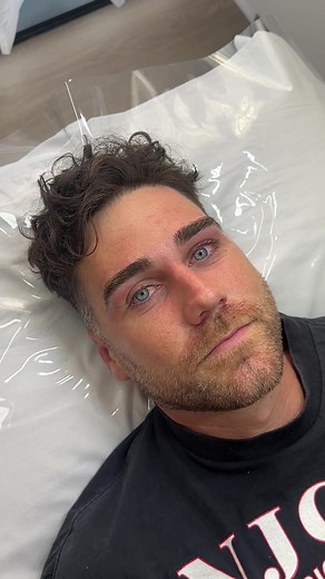 Male Brow Wax 🔥 Thank you to my beautiful boyfriend for always being my biggest support, letting me make reels of him and pushing me to quit my job to start Fayse Club. Men deserve as much love and maintenance as the rest of us! Treatment includes -Brow cleanse -Wax -Tweezing -Trimming -Aftercare with a brow massage Book your men in and they will be saying ‘i can’t believe I didn’t I do this sooner’ I promise you! 🫶🏻 #fyp #mensbrows #mensbrowwax #mensbrowshaping #browsgoldcoast #trending