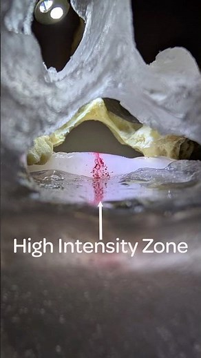 High Intensity Zone Modelling by Dynamic Disc Designs