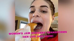 33 Screws, One New Life: The Jaw Surgery That Transformed This Young Woman