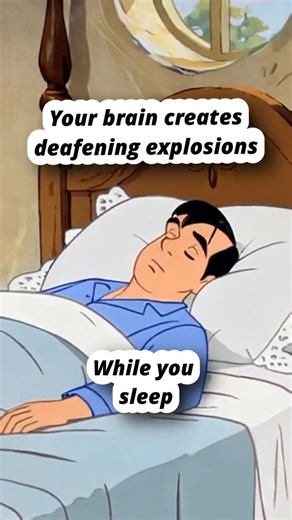 EXPLODING HEAD SYNDROME Creates Deafening Brain Explosions #Shorts