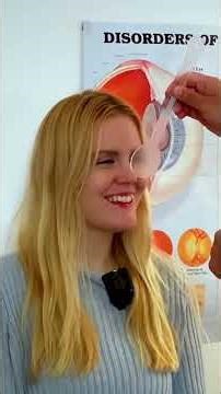 Eye Redness Test Simple Comparison for Your Vision