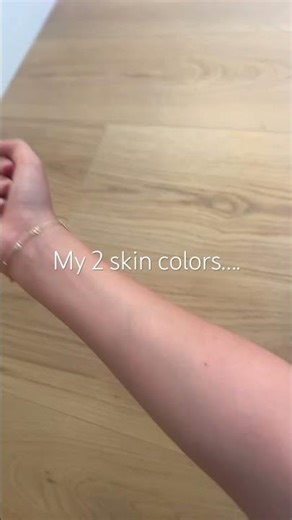 My 2 skin colors.. #preppy #arm