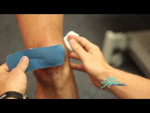 Taping - Patellofemoral Pain Syndrome