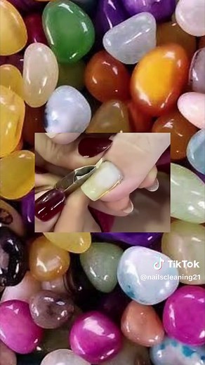 Nail cleaning 💅 #nail #nailcleaning #toenail #toenails #nails #toenailremoval #ingrownhairremoval