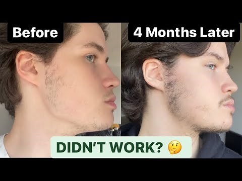 Copenhagen Grooming Beard Growth Kit (REVIEW)