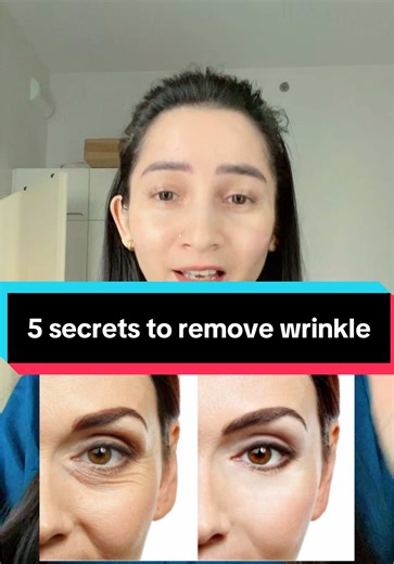 5 secrets to remove wrinkle #finelines\t #skincareroutine #aesthetics\t #microneedling\t #SkincareNepal #presuskincare #chitwan_muser