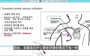 Lecture tube control_02