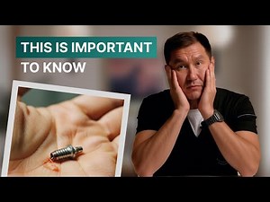 TRUTH about implants: who shouldn't have them, why they can fall out. What you need to know in 2026
