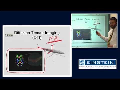 Introducing MRI: Diffusion Tensor Imaging (50 of 56)