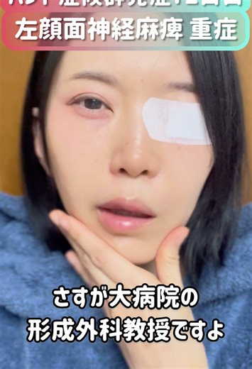 ハント症候群と闘う72日目の記録