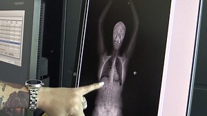 In February 2019, Washington Corrections Center for Women installed a body scanner in the facility’s visitation room. Operations for the new scanner began in April. Corrections specialist Jennifer Grabil says that preventing dangerous contraband from entering the prison is vital to the facility’s security. In the few months the scanner has been operational, staff have seized one hundred strips of suboxone, thirteen grams of heroin, and seventeen grams of meth from inmates. “I think it’s keeping 