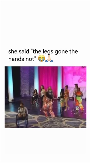 Dumb on Instagram: "Artists with limb differences proving themselves in music isn’t rare — and it’s real. Neuroscience shows that creativity and rhythm aren’t limited by physical ability; they’re driven by the brain’s auditory and motor networks. Many performers with disabilities develop exceptional timing, breath control, and lyrical focus because they rely more on internal rhythm than movement. Interestingly, studies on neuroplasticity show that when one physical pathway is limited, the brain 