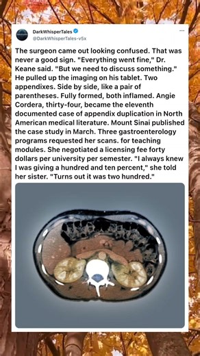 WOMAN'S EMERGENCY APPENDECTOMY REVEALS SHE HAS TWO APPENDIXES
