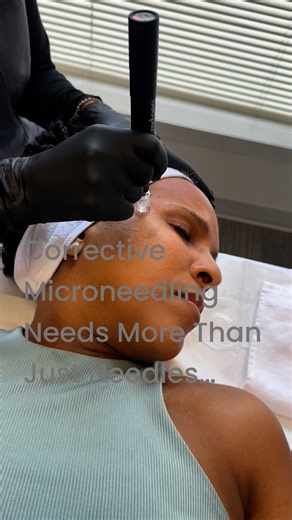 MDPen UltraGlide Products & Their Role in Microneedling Microneedling works best when your skin has the right support to heal, hydrate, and build new collagen. That’s why we use the MDPen UltraGlide Serum Kit before and after treatment: •Pure Hyaluronic Serum – restores deep hydration & elasticity •Copper HA Mist – cools, nourishes & boosts collagen •Human Derived Growth Factor Gel – speeds recovery & smooths fine lines •Tighten Lift Serum – firms & refreshes tired skin •Cellular Renewal Serum –