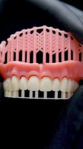 SprintRay Denture Base and Teeth Launch Vertical
