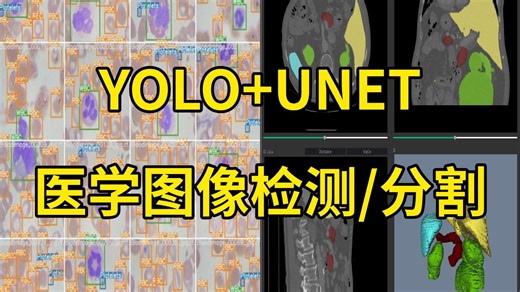 医学研究生必备！基于YOLO与UNET的医学图像检测与分割实战，迪哥手把手带你做实战！（深度学习/计算机视觉/人工智能/医学生）
