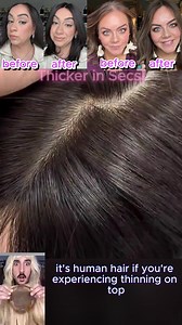 Say goodbye to bad hair days! 👋 Our premium hair toppers are your invisible solution to thinning hair: 🌟 100% real human hair 🌟 Perfectly blends with your natural locks 🌟 Style, dye, or curl as you wish! Ready to transform your look? Click to discover more! ✨ | Ushairtopper-UK