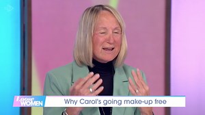 Loose Women's Carol McGiffin speaks out after her face is 'like a tomato'