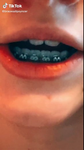 I win🤪 you lose 🙄👉 #baddie #lipsyncing #iwinyoulose #baddietiktok #braces #lipsinging