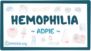 Hemophilia: Nursing process (ADPIE): Video, Causes, & Meaning | Osmosis