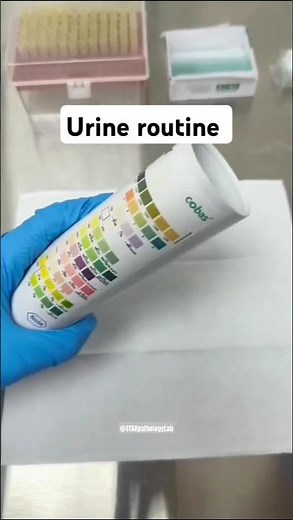 Urine Routine Test: Early Detection of Kidney & Diabetes Problems!#microscope #laboratory #shorts