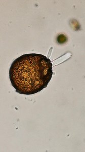 Testate amoeba difflugia and its pseudopoda. | Guido Guidotti