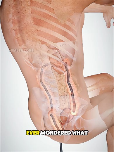 Colon Polypectomy Explained: Safe Polyp Removal Process