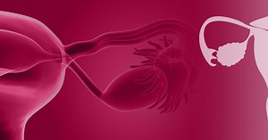 Hirsutism Guideline Resources