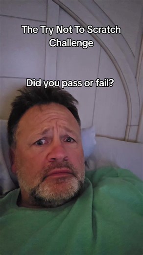 #stitch with @hewhowashere #gross #lice #challenge #fypシ゚viral