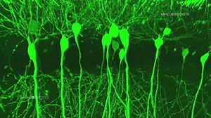 Optics shed new light on the brain