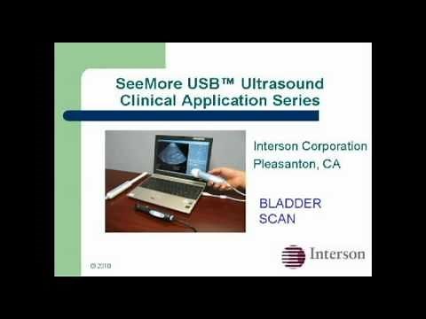 SeeMore Ultrasound Bladder Scan