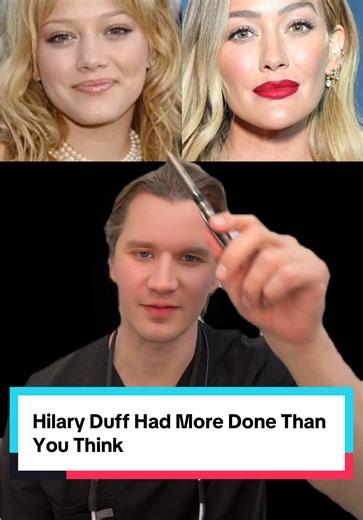 Hillary Duff may have gotten more plastic surgery than you think! Do you agree with my analysis?