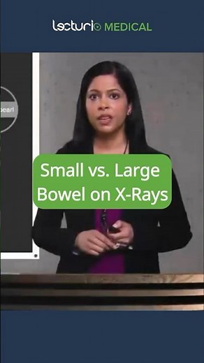 🔎 Small vs. Large Bowel: X-Ray Clues! #Radiology #Gastroenterology #USMLE