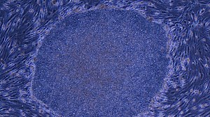 iPS細胞由来の再生医療製品が世界初の承認、日本から実用化されたことの意味