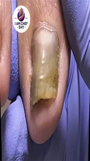 2.5K views | Gentle Solutions for People Over 50 to Care for Feet Naturally  #FootSupport #FootWellnessUSA #SafeNailCare | I am Chef Shy | Facebook