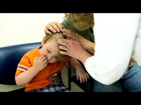 A Rare Case of Bobble-Head Doll Syndrome