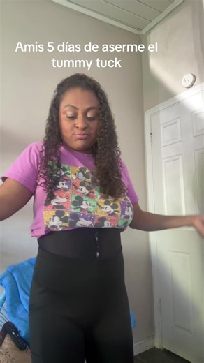 Understanding the Tummy Tuck Procedure