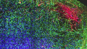 Video. Replacing animal testing with cultured human cells