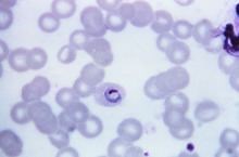 Plasmodium ovale - Alchetron, The Free Social Encyclopedia