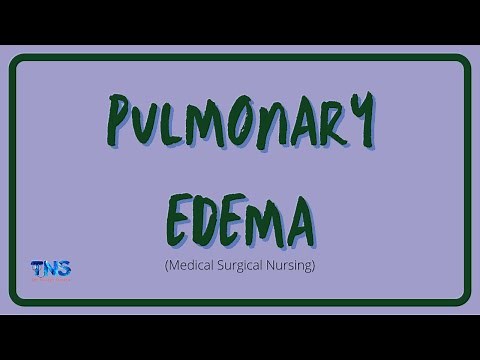 PULMONARY EDEMA | Causes | Pathophysiology | Nursing Management | Diagnosis | The Nurses Station
